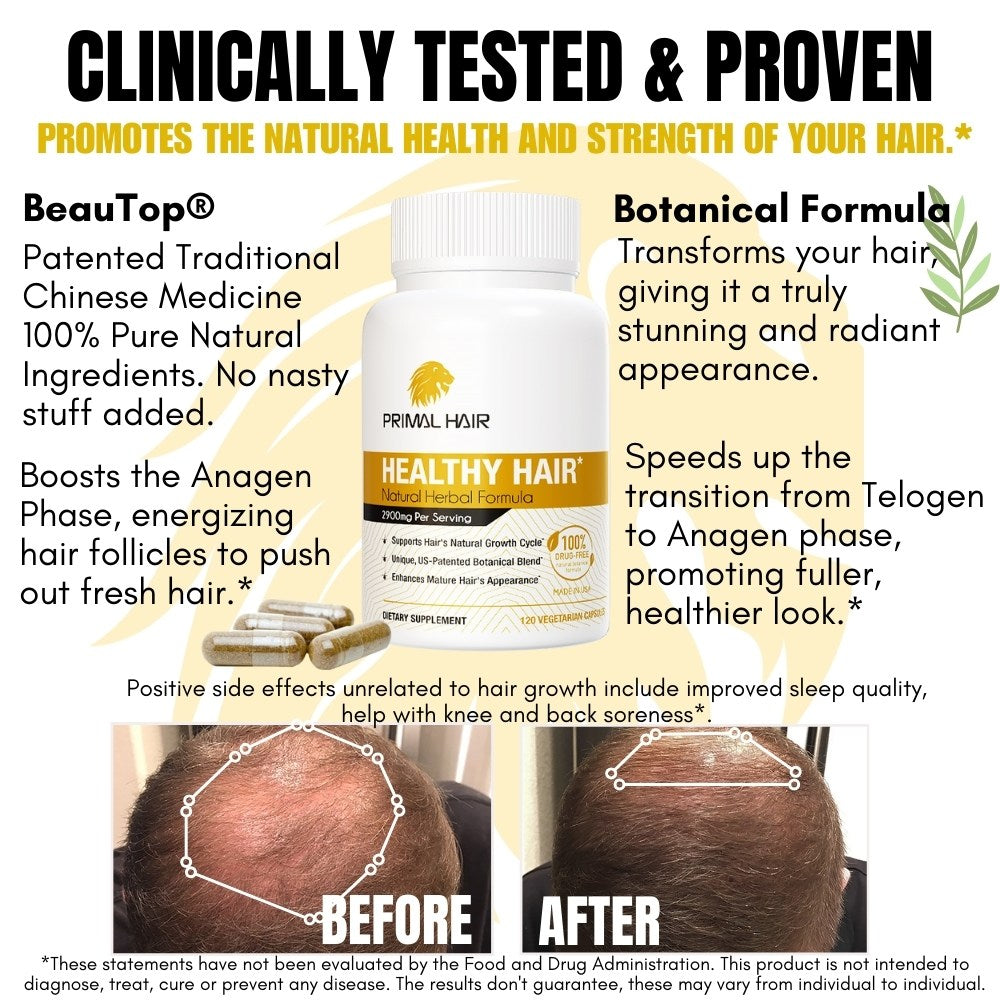 Primal Hair - 100% Natural Growth Treatment, Reduces Hair Loss, US Patented Formula Proven Effective for Men & Women, 100% Vegan Ingredients, Non-GMO
