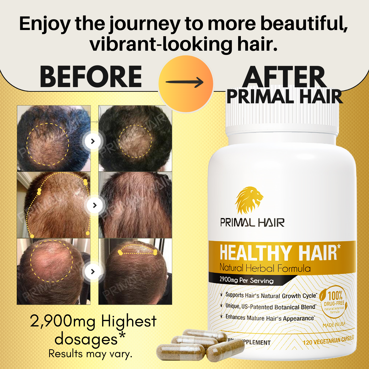 Primal Hair - 100% Natural Growth Treatment, Reduces Hair Loss, US Patented Formula Proven Effective for Men & Women, 100% Vegan Ingredients, Non-GMO